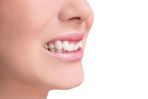 Răng khểnh có thể gây nên một số tác hại cho sức khỏe răng miệng