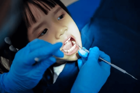 Địa chỉ nhổ răng mọc lẫy cho bé chất lượng và những lưu ý cần biết