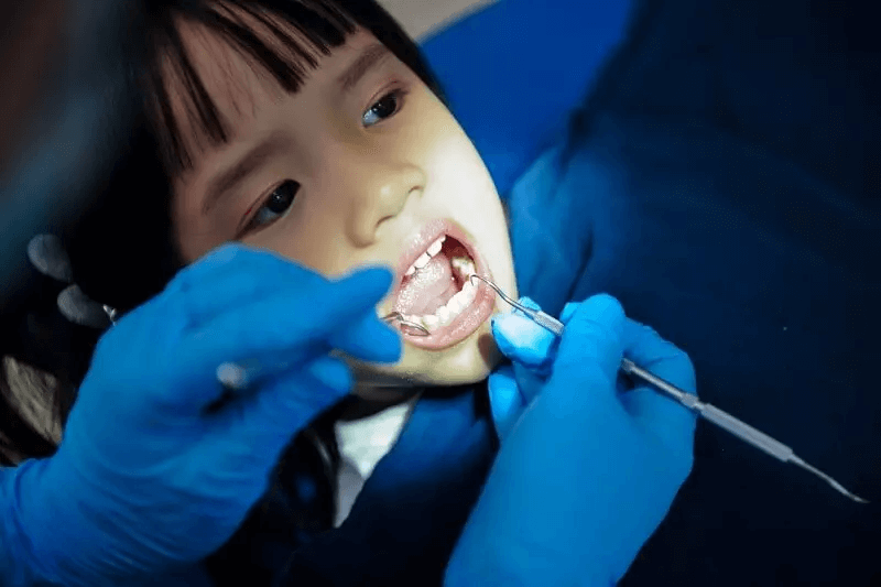 Cần đưa bé đến các phòng khám nha khoa ngay khi phát hiện dấu hiệu của răng mọc lẫy
