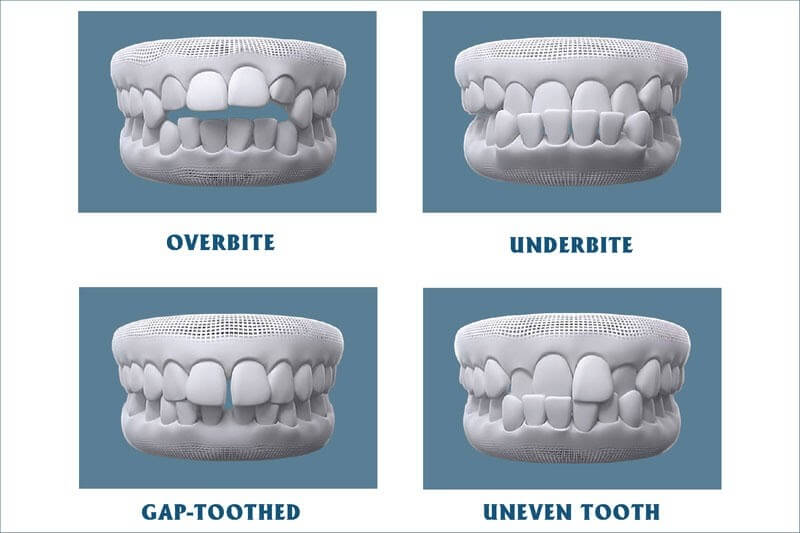 Các tình trạng răng miệng phổ biến cần chỉnh hình làm đẹp