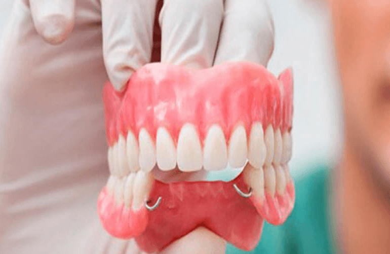 Lắp răng giả, răng hàm tháo lắp khiến nước bọt có mùi hôi