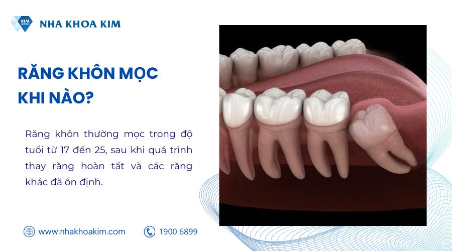 Răng khôn mọc khi nào