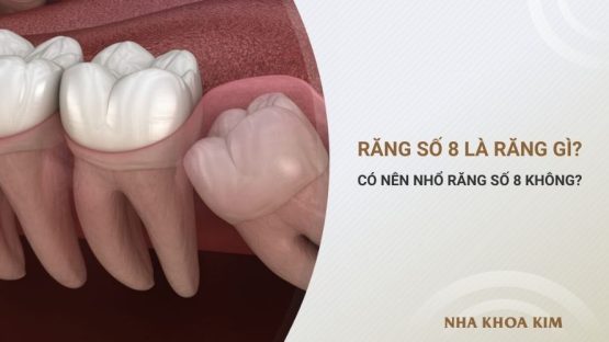 Răng số 8 là răng gì? Có nên nhổ răng số 8 không?