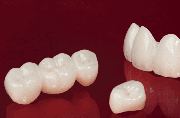 Tính thẩm mỹ cao cho hàm răng
