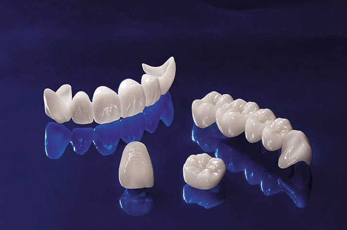 Răng sứ Ceramill Zolid có nhiều ưu điểm vượt trội