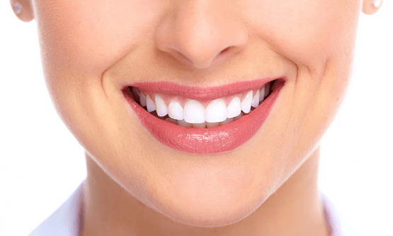 Răng sứ Cercon XT – Tiêu chuẩn mới cho răng sứ thẩm mỹ