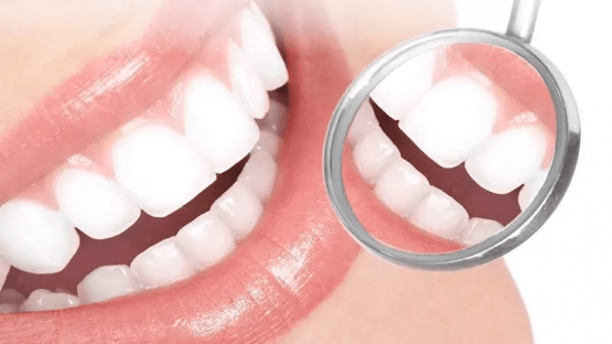 Tổng quan về răng sứ SAGE – Dịch vu trồng răng sứ SAGE tại Nha Khoa Kim