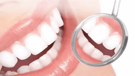 Tổng quan về răng sứ SAGE – Dịch vu trồng răng sứ SAGE tại Nha Khoa Kim