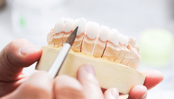 Tại sao làm răng sứ Zirconia HT ngày càng được ưa chuộng?