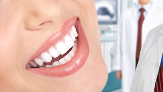 Răng sứ Cercon và Lava có những điểm khác nhau nào? Loại nào tốt hơn?