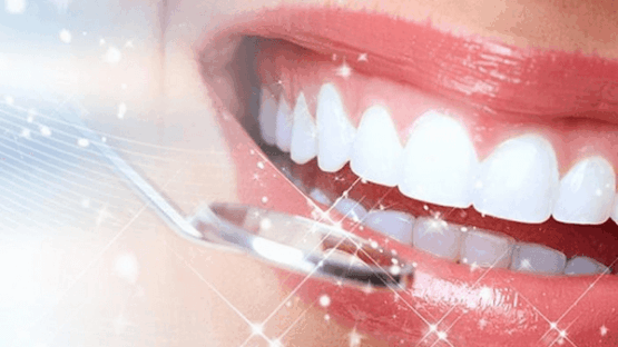 Răng sứ zirconia bảo hành bao lâu ? Làm thế nào để kéo dài tuổi thọ?