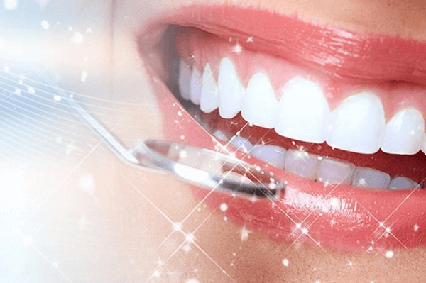 Răng sứ zirconia bảo hành bao lâu?