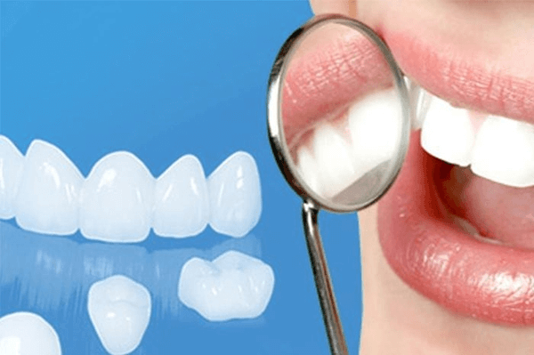 Răng sứ zirconia có ưu điểm gì?