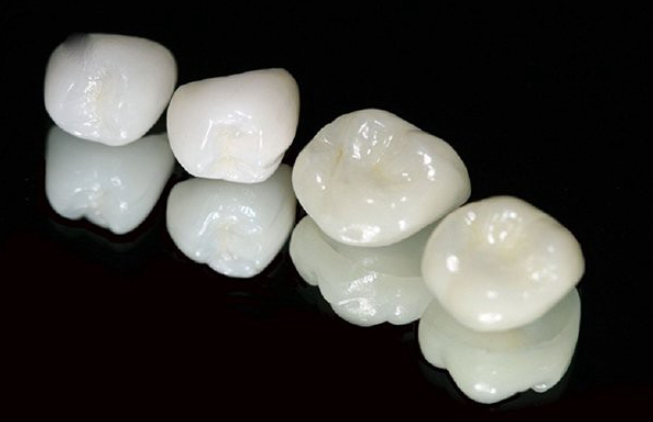 Hình ảnh răng toàn sứ Alumina