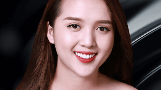 Răng toàn sứ DDBio của nước nào? Có tốt không?