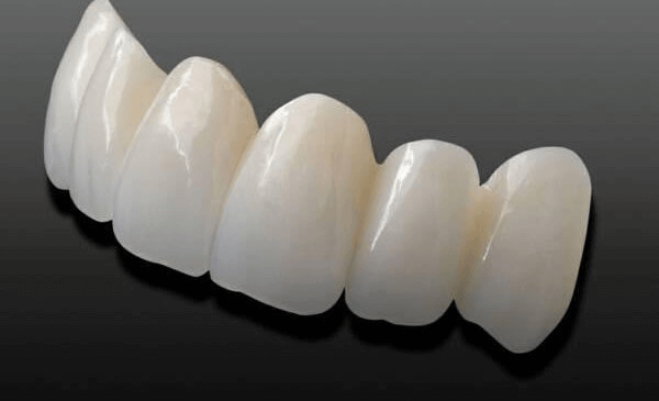Răng sứ Cercon