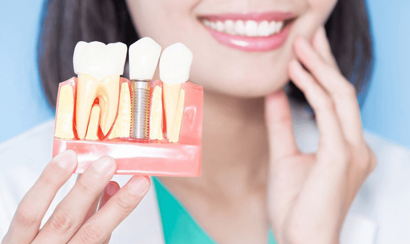 Những ưu điểm của kỹ thuật cấy ghép implant tức thì 