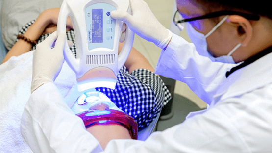 Dịch vụ tẩy trắng răng Laser Whitening uy tín tại Nha Khoa Kim