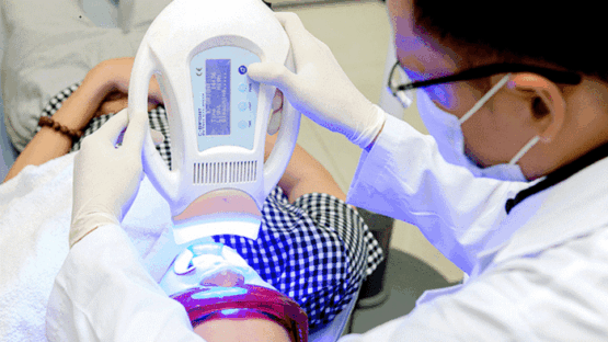 Dịch vụ tẩy trắng răng Laser Whitening uy tín tại Nha Khoa Kim