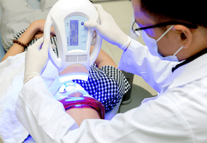 Quy trình làm trắng răng bằng công nghệ Laser Whitening