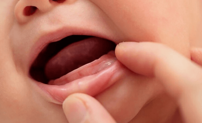 Trẻ mấy tháng mọc răng?