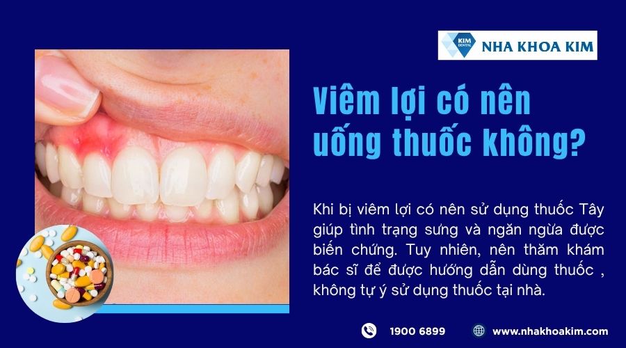 Viêm lợi có nên uống thuốc không?