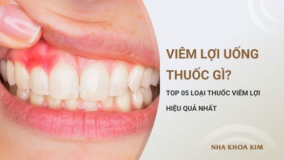 Viêm lợi uống thuốc gì? Top 05 loại thuốc viêm lợi hiệu quả nhất
