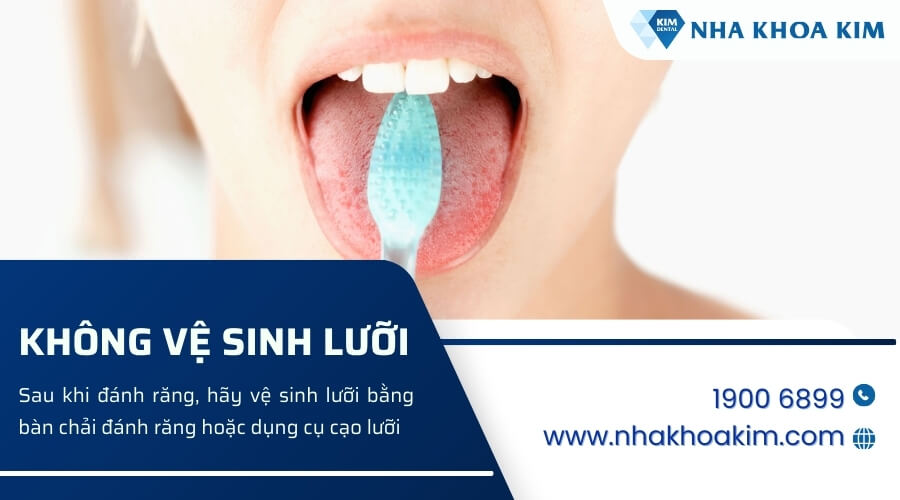 Không vệ sinh lưỡi