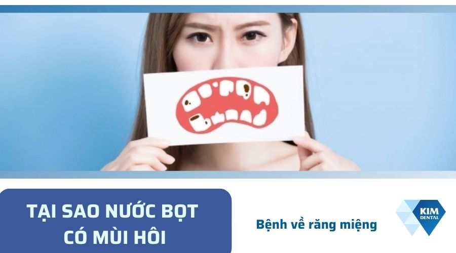 Nước bọt có mùi hôi do nhiễm các bệnh về răng miệng