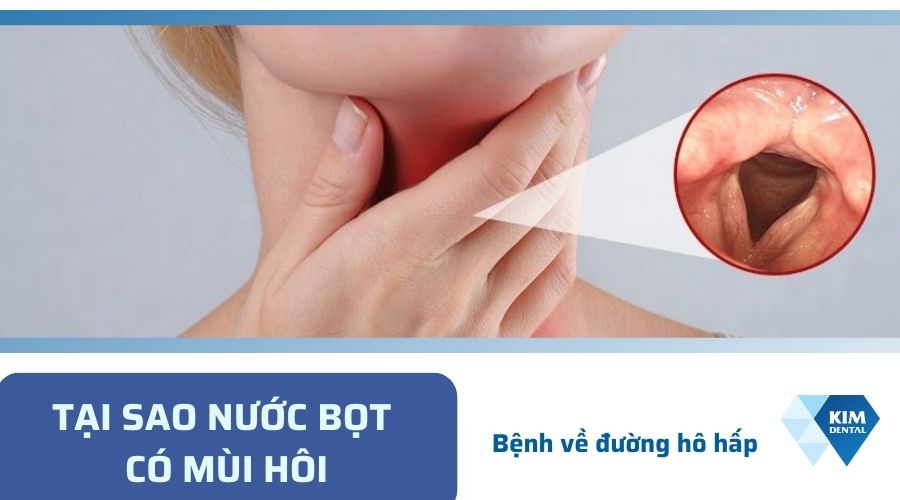 Nước bọt có mùi hôi do các bệnh về hô hấp
