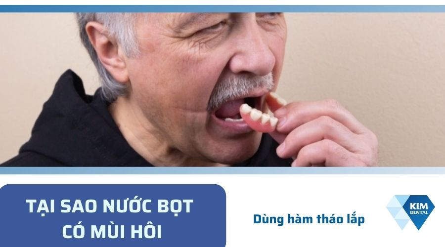 Nước bọt có mùi hôi do sử dụng hàm giả tháo lắp