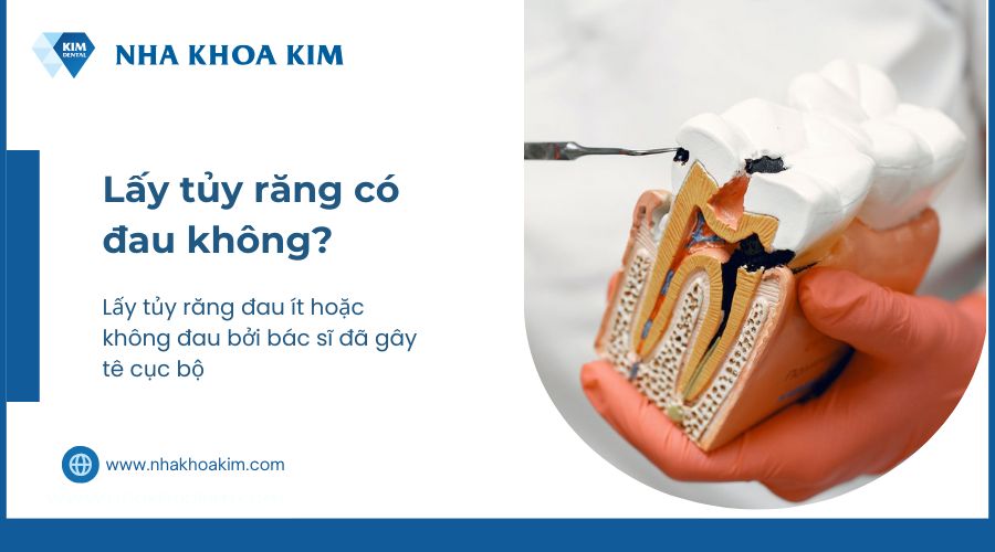 vậy thì lấy tủy răng có đau không