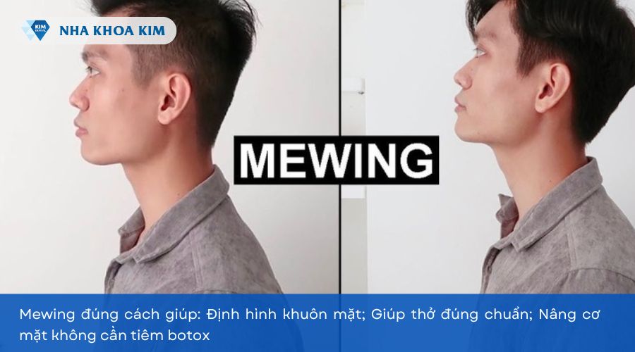 Tập mewing có tác dụng gì