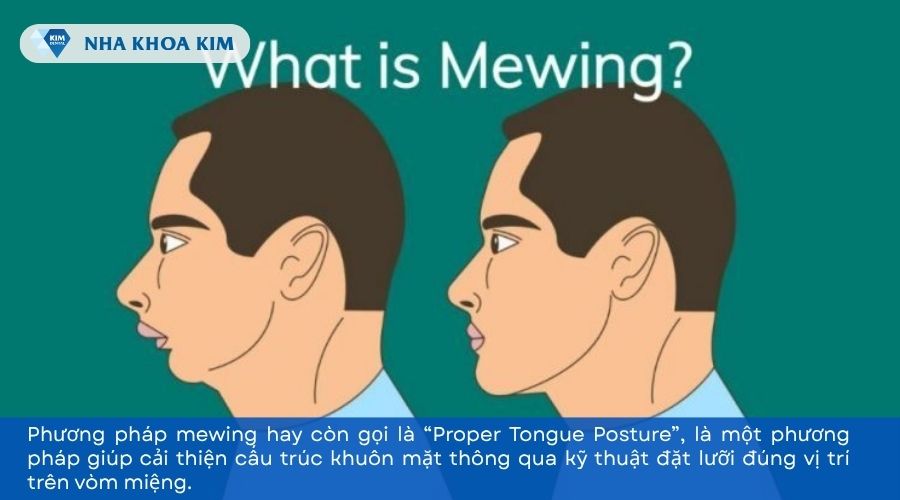 Mewing là gì
