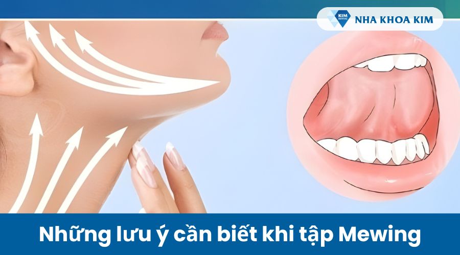 Những lưu ý cần biết khi tập mewing