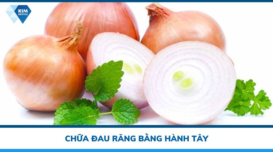 chữa đau răng bằng hành tây