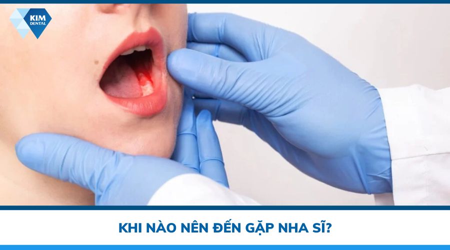 khi nào đến gặp nha sĩ chữa đau răng