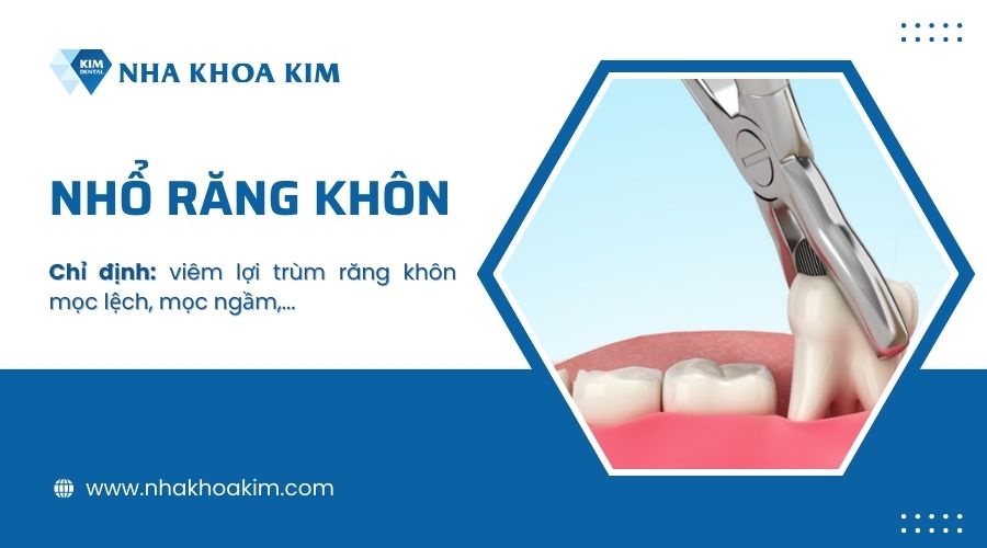 Cách điều trị viêm lợi trùm răng khôn