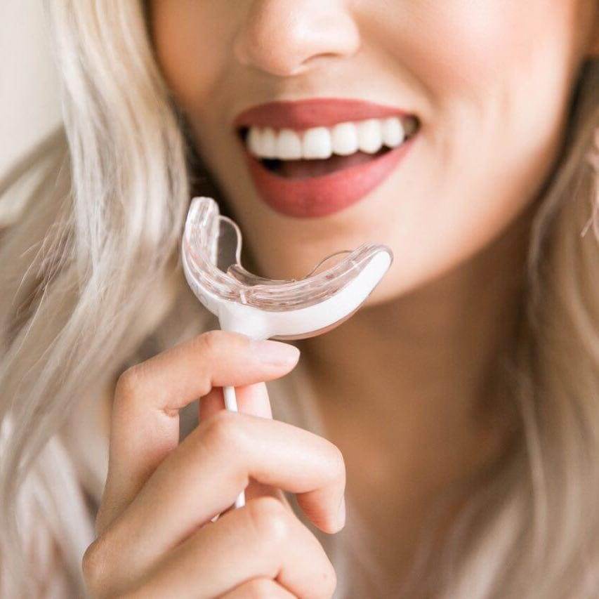 Sử dụng máy làm trắng răng để làm trắng răng nhanh chóng tại nhà