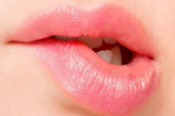 Vô tình cắn phải môi cũng có thể là nguyên nhân khiến bạn bị lở miệng