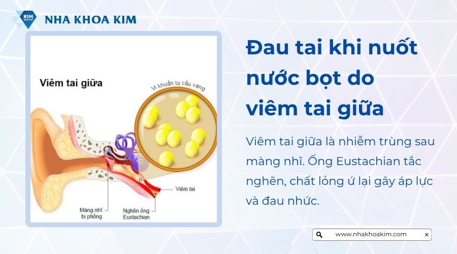 Viêm tai giữa nguyên nhân nuốt nước bọt đau tai