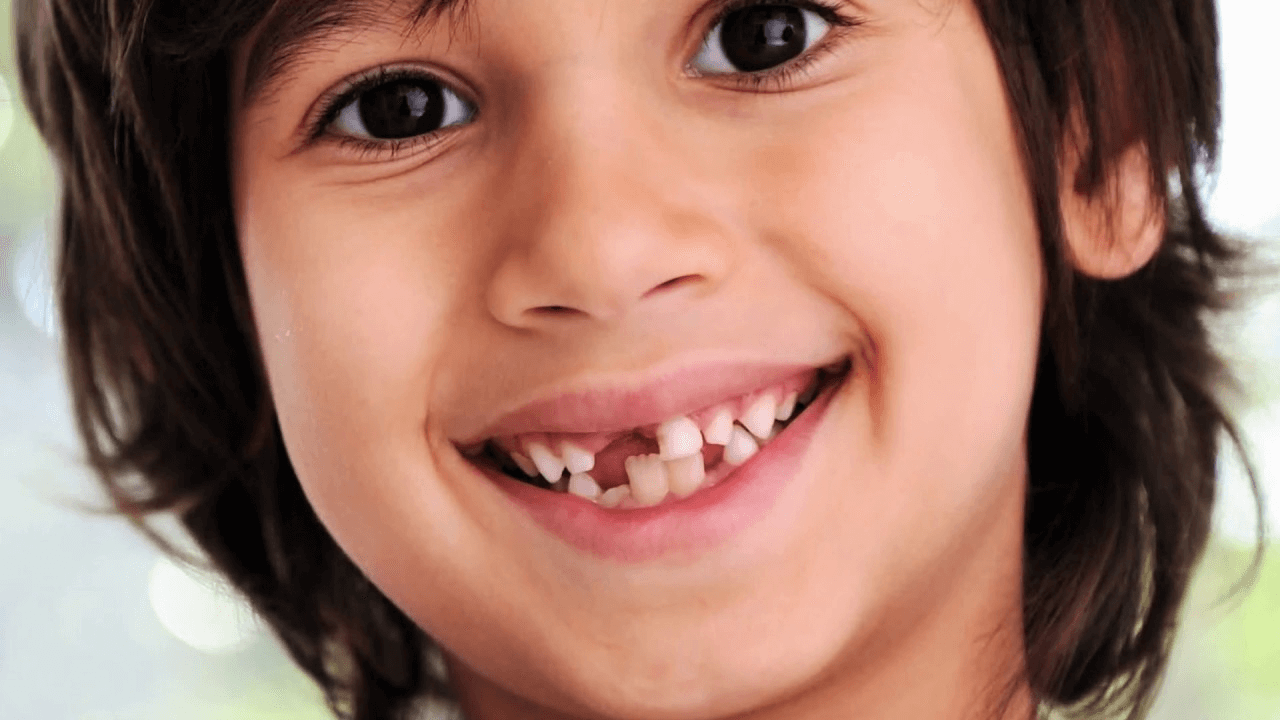 Đặc điểm răng sữa ở trẻ nhỏ
