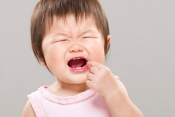 Mọc răng có thể gây sưng nướu ở trẻ