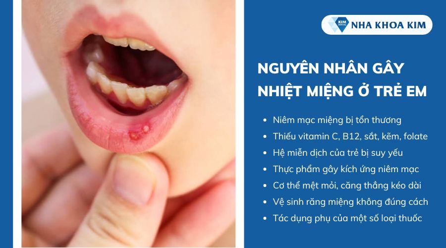 nguyên nhân khiến trẻ bị nhiệt miệng
