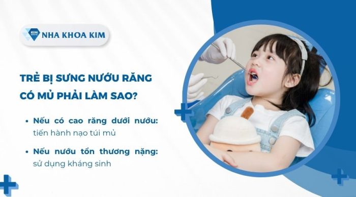 Trẻ bị sưng nướu răng có mủ phải làm sao?