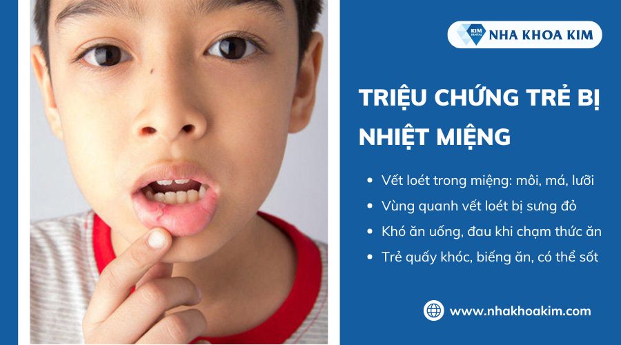 dấu hiệu nhiệt miệng ở trẻ 