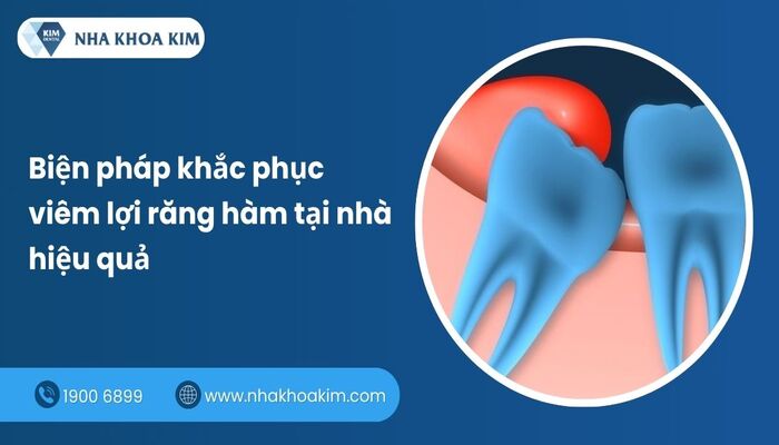 cách khắc phục viêm lợi răng hàm tại nhà