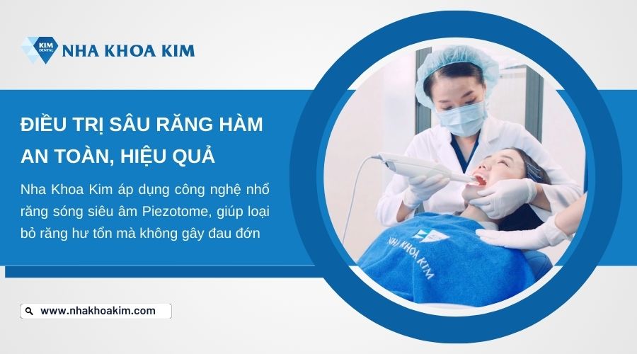 địa chỉ điều trị răng hàm bị sâu 