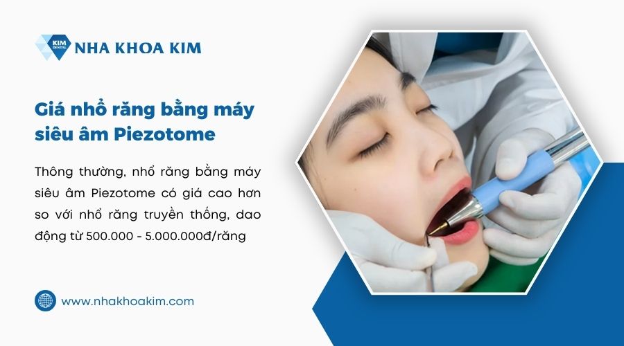 Nhổ răng bằng máy siêu âm piezotome giá bao nhiêu