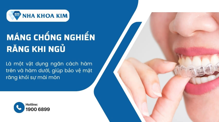 Sử dụng máng chống nghiến răng